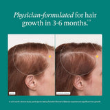 Nutrafol Women’s Balance Pack of 3 (3-Month Supply) – Hair Growth Supplements for Women 45+ | Clinically Tested Thicker Hair & Scalp Coverage