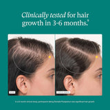 Nutrafol Postpartum Hair Growth Supplement – Breastfeeding-Friendly Hair Vitamins for Postpartum Hair Loss Support | 120 Capsules