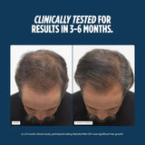Hair growth supplements for men over 50
