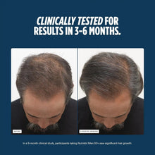 Hair growth supplements for men over 50